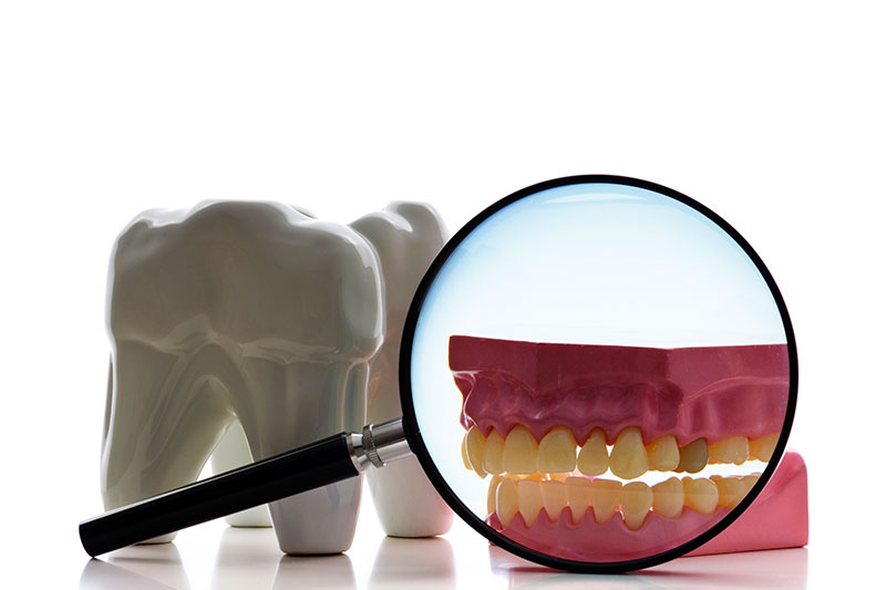 Root Canal in Fairlawn