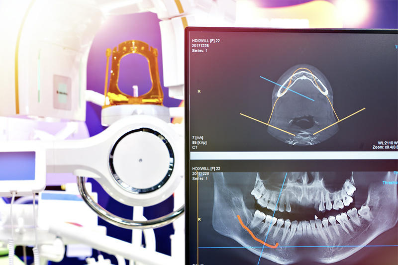 Digital X-Rays in Fairlawn